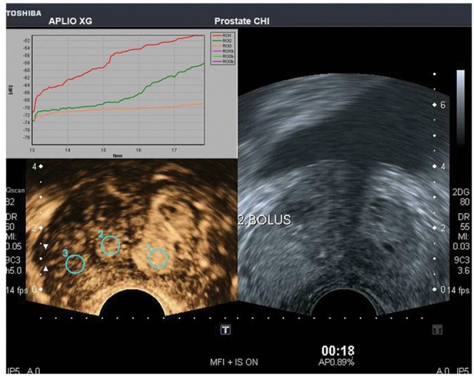 Figure 13