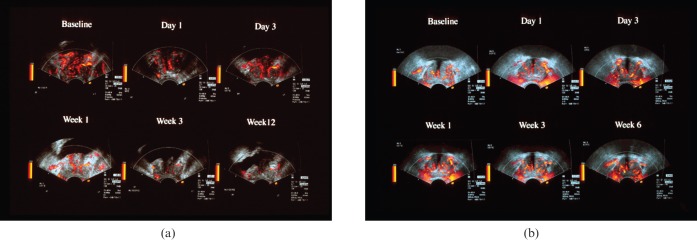 Figure 15