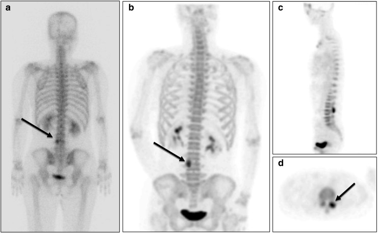 Fig. 2a–d