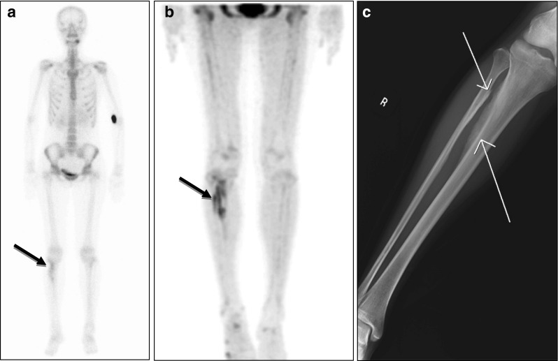 Fig. 5a–c