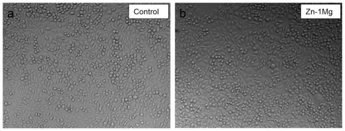 FIGURE 11