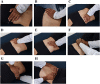 Fig 3