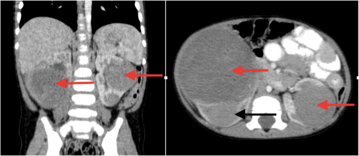 Fig. 3A