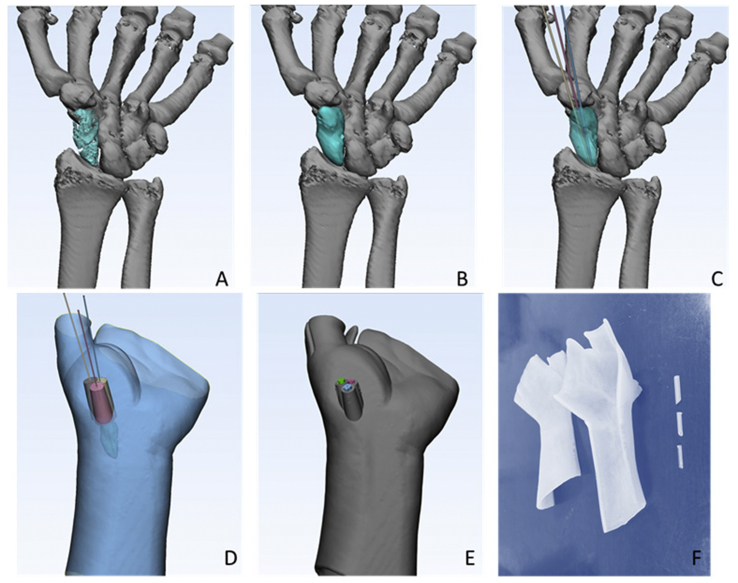 Figure 1