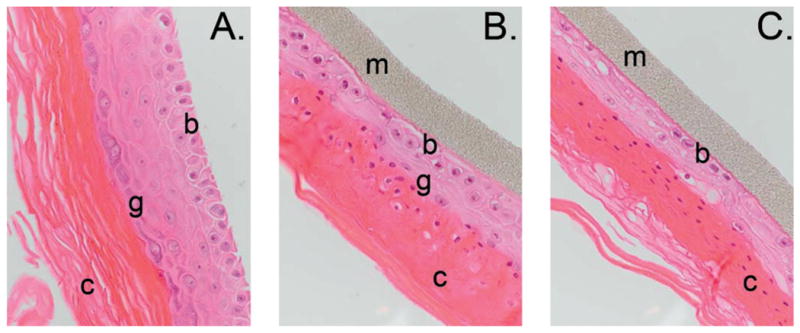 FIG. 1