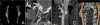Fig. 13