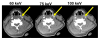 Fig. 11
