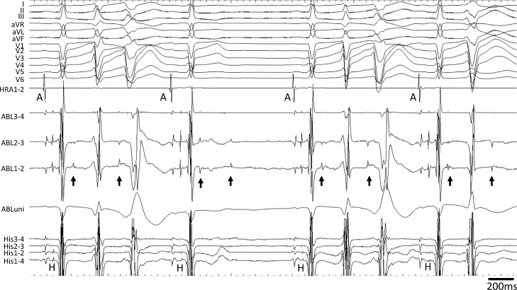 Fig 2: