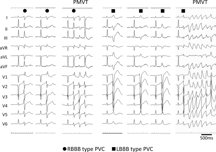 Fig 1: