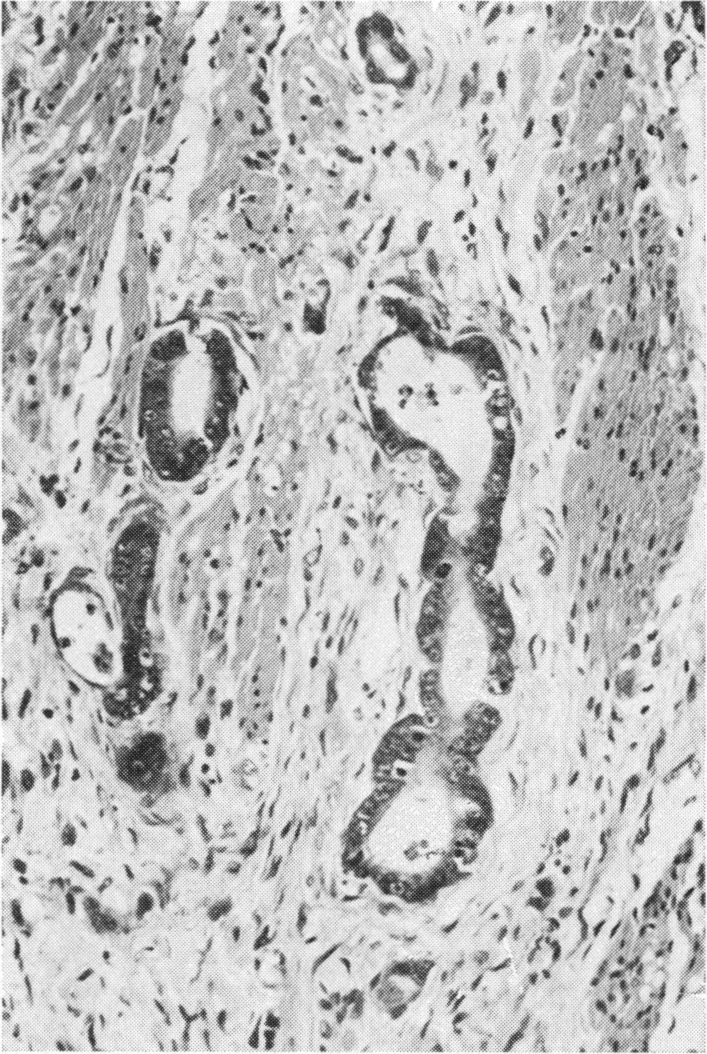 Fig. 12