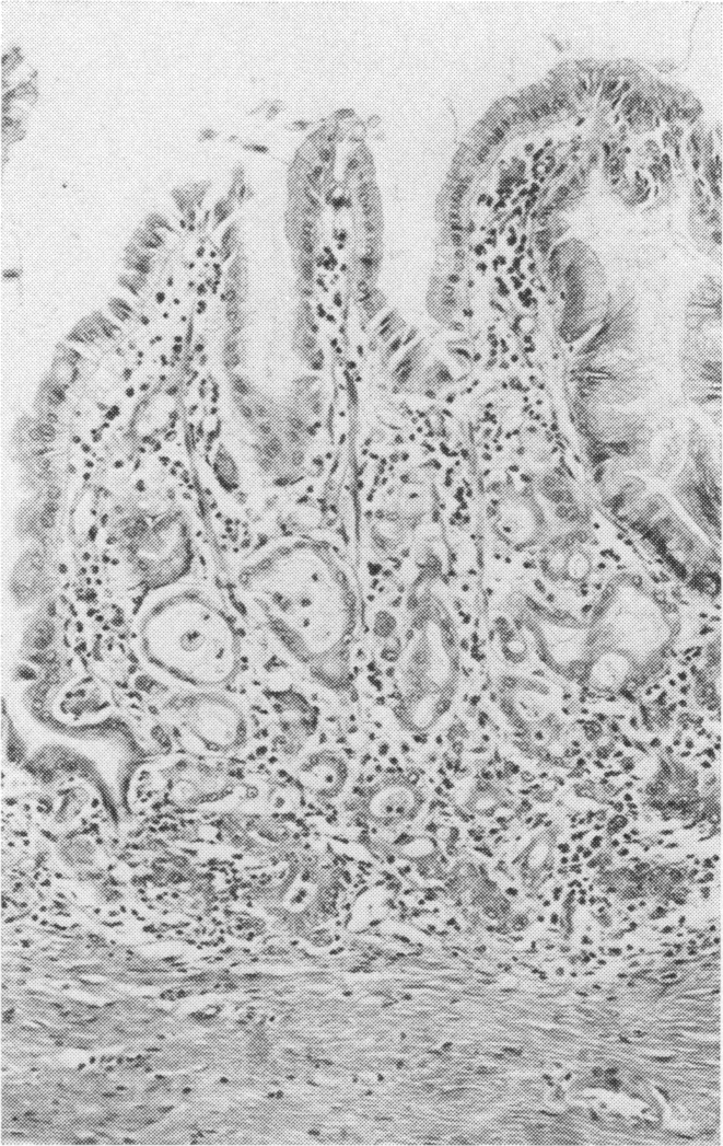 Fig. 20