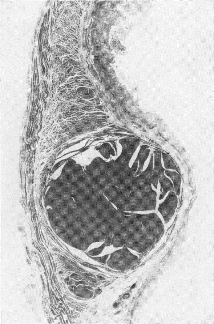 Fig. 25