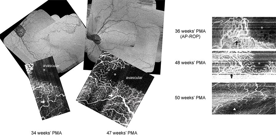 FIG 1.