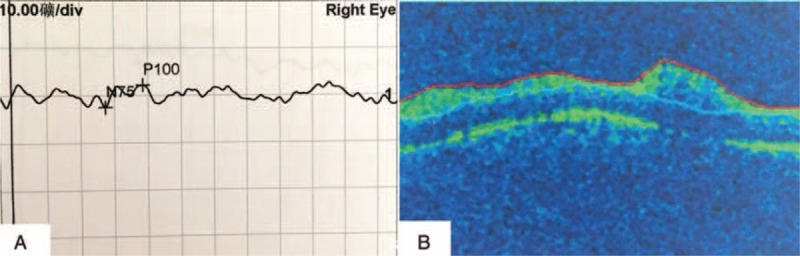 FIGURE 4