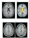 FIG. 1