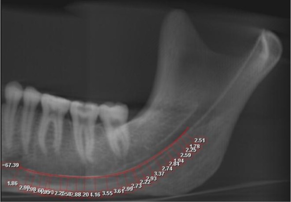 Fig. 3