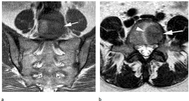 Figure 11.