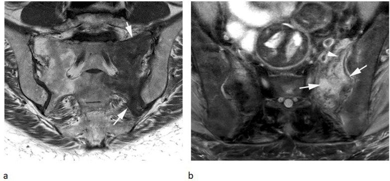 Figure 15.