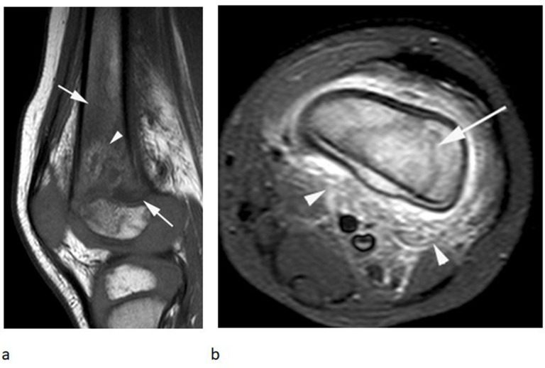 Figure 17.