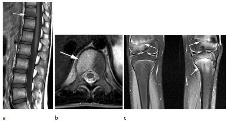 Figure 18.