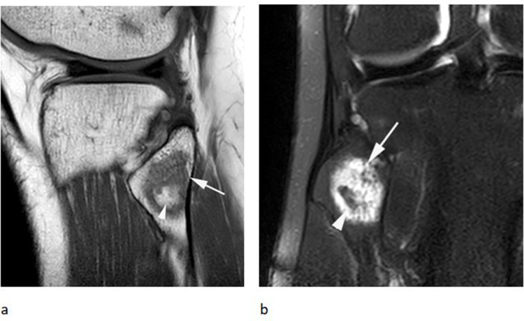 Figure 20.