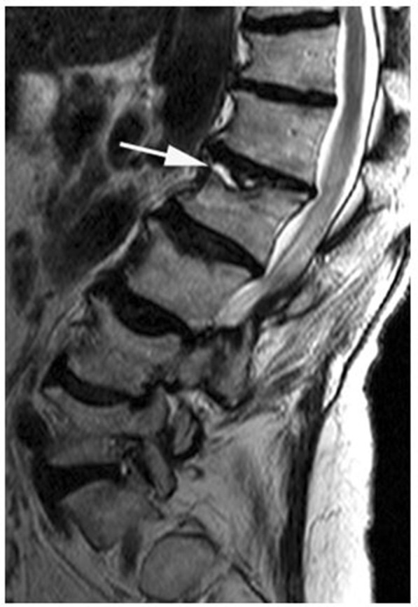 Figure 14.