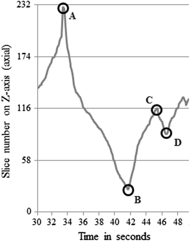 Fig. 3