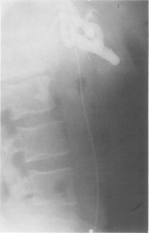 Fig. 1C.