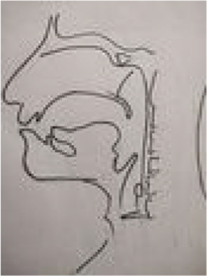 Fig. 11