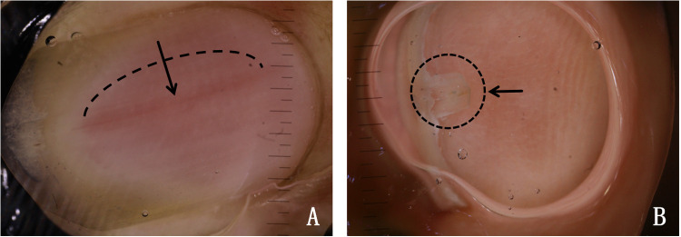 Fig. 2