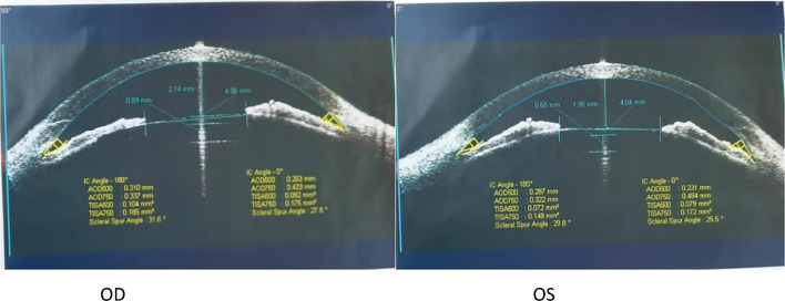 Fig. 3