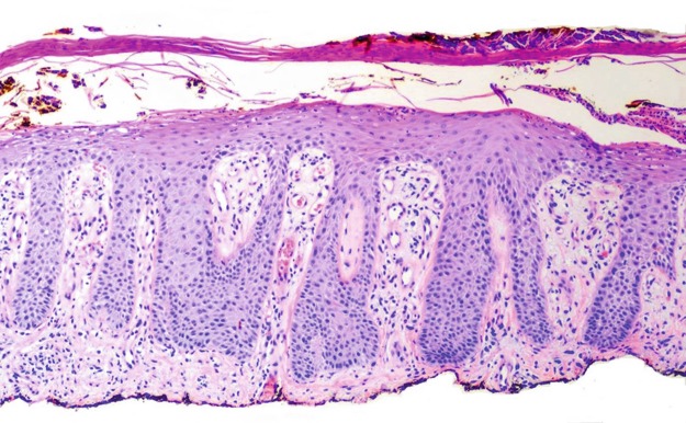 Fig. 1.19