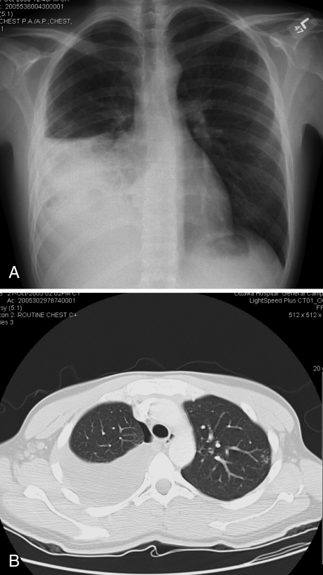 Figure 2)