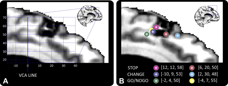 Fig. 4