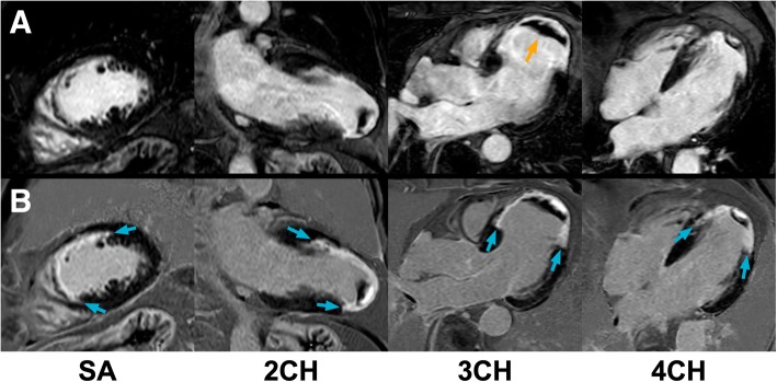 Fig. 2