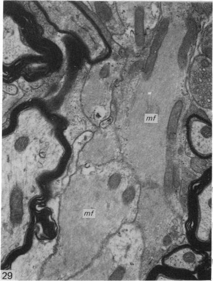 Fig. 29