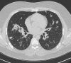 Fig 3.