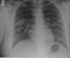 Fig 1.