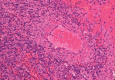Fig 2.