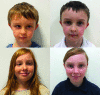 Sibling 1 (top row) and sibling 2 (bottom row) pre–operatively and at three–months post–operatively. All images in primary position