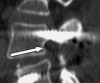 Fig. 6