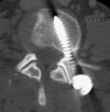 Fig. 5