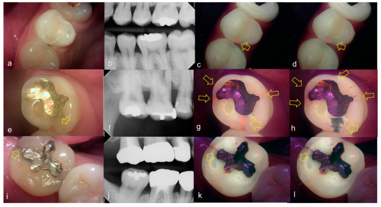 Figure 10