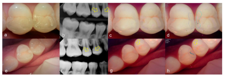 Figure 6