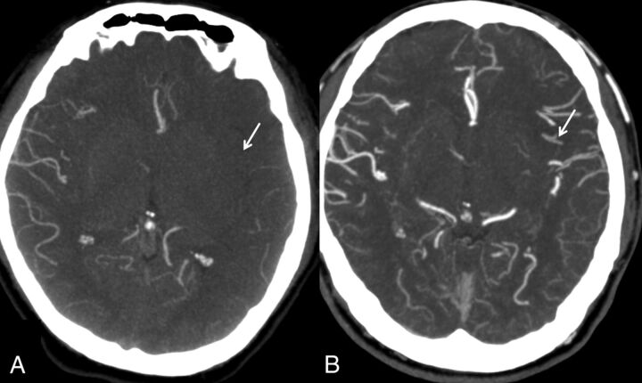 Fig 3.