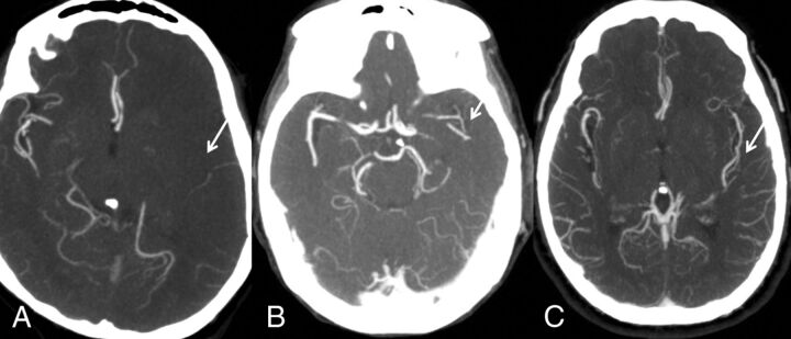 Fig 1.