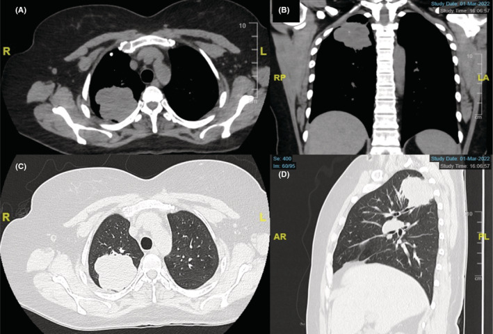 FIGURE 2