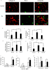 Figure 1A is a stained tissue displays three columns, namely, Collagen 4, Thioflavin S, and Composite, and two columns, namely, Control and Lead with 50 micrometers. Figures 1B to 1E is a bar graphs, plotting total amyloid plaque number, ranging from 0 to 600 in increments of 200; Vascular plaque number, ranging from 0 to 40 in increments of 10; ratio of vascular amyloid or total amyloid, ranging from 0.00 to 0.08 in increments of 0.02; and number of amyloid positive vessels, ranging from 0 to 25 in increments of 5 (y-axis) across control, lead, and lead plus tiplaxtinin (x-axis).Figure 1F to 1H are bar graphs, plotting beta amyloid 1 to 40 (nanogram per milligram), ranging from 0 to 80 in increments of 20; beta amyloid 1 to 42 (nanogram per milligram), ranging from 0 to 150 in increments of 50; and Ratio of beta amyloid 1 to 40 or 1 to 42 (y-axis) across parenchyma and vascular (x-axis) for control and lead.