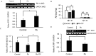 Figure 4A is a set of one western blot and one bar graph. The western blot displays control and lead across the top as columns and plasminogen activator inhibitor-1 45 kilodalton and glyceraldehyde 3-phosphate dehydrogenase 36 kilodalton across the left as rows. The bar graph, plotting ratio of plasminogen activator inhibitor-1 or glyceraldehyde 3-phosphate dehydrogenase, ranging from 0.0 to 2.0 in increments of 0.2 (y-axis) across control and lead (x-axis). Figure 4B is a clustered bar graph, plotting beta amyloid (nanogram per milligram), ranging from 0 to 80 in increments of 20 (y-axis) across beta amyloid 1 to 40 and beta amyloid 1 to 42 (x-axis) for control, lead, and lead plus tiplaxtinin. Figure 4C is a bar graph, plotting ratio of beta amyloid 1 to 40 or 1 to 42 (y-axis) across control, lead, and lead plus tiplaxtinin (x-axis). Figure 4D is a set of one western blot and one bar graph. The western blot displays control and lead across the top as columns and low-density lipoprotein receptor-related protein 1 85 kilodalton and glyceraldehyde 3-phosphate dehydrogenase 36 kilodalton across the left as rows. The bar graph, plotting ratio of low-density lipoprotein receptor-related protein 1 or glyceraldehyde 3-phosphate dehydrogenase, ranging from 0 to 1.6 in increments of 0.4 (y-axis) across control and lead (x-axis).