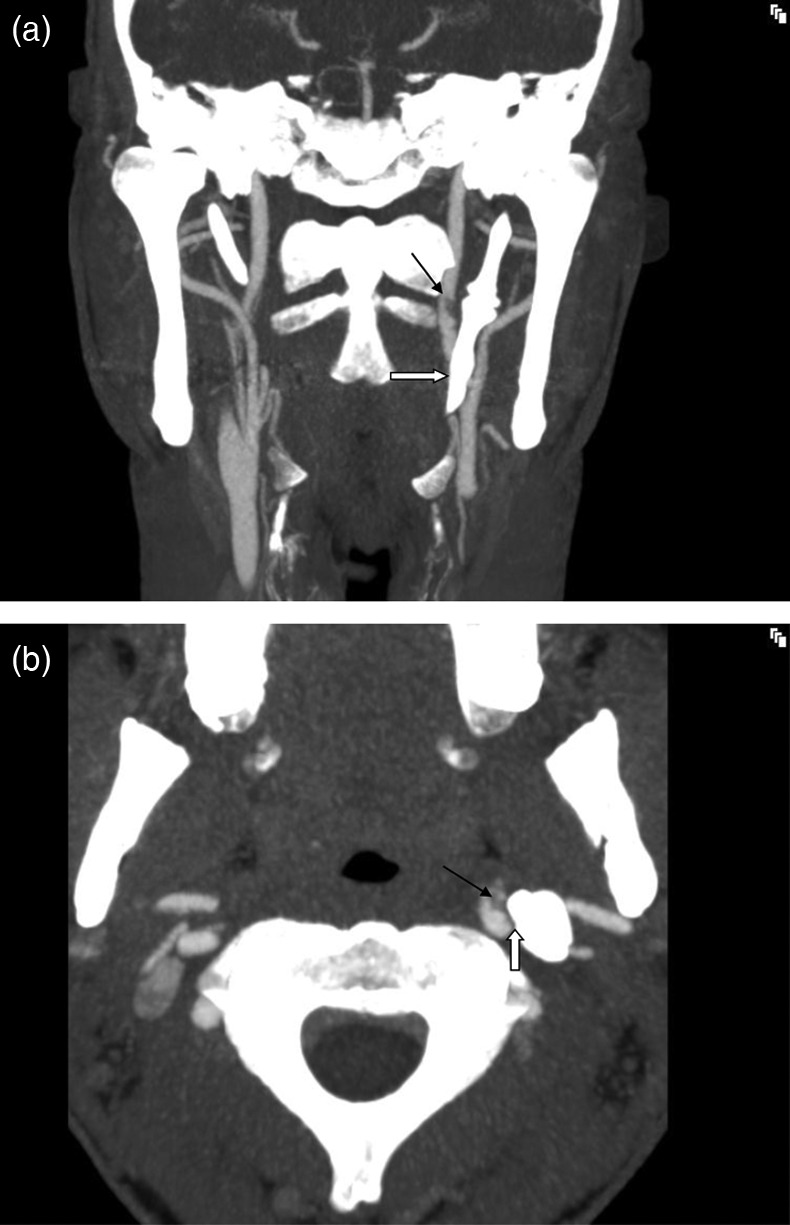 Figure 1